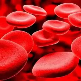Anemia Sierpowata