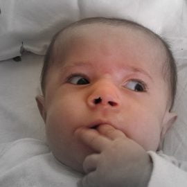 Dystrofia miotoniczna