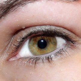 Hipercholesterolemia rodzinna