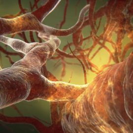 Podwyższony poziom amoniaku we krwi - HIPERAMONEMIA