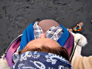 Zespół Bassena-Kornzweiga