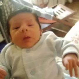 Choroba Hallervordena-Spatza