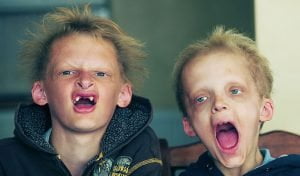 Dysplazja ektodermalna
