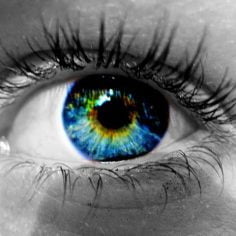 heterochromia