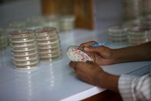 Zespół Łamliwego Chromosomu X