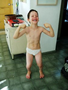 Dystrofia mięśniowa