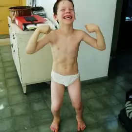 Dystrofia mięśniowa