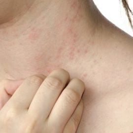 alergia pokarmowa u dorosłych