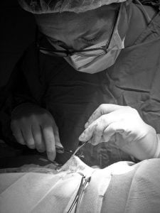 Usuniecie torbieli jajników