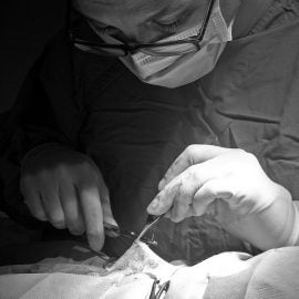 Usuniecie torbieli jajników