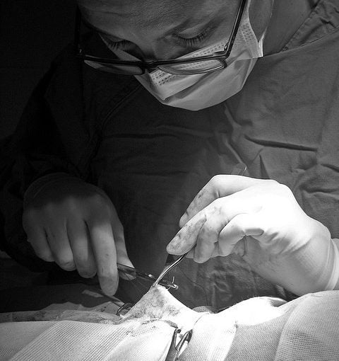 Usuniecie torbieli jajników