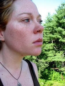 Zapalenie przydatków