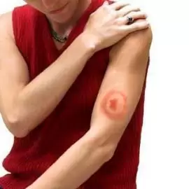 Borelioza przewlekła