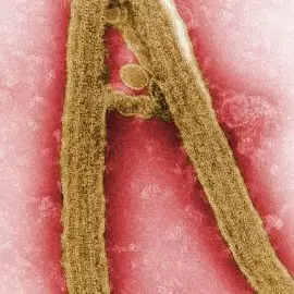 Gorączka krwotoczna