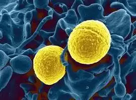 Gronkowiec złocisty