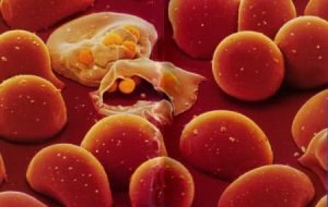 malaria