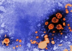 Zapalenie wątroby typu B