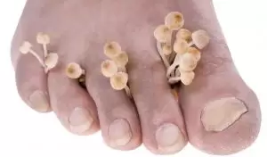 kwas kaprylowy
