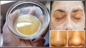 peeling