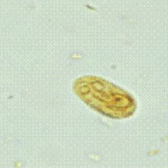 lamblioza