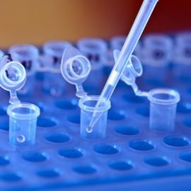 Choroba Niemanna-Picka