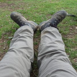 Wrodzony brak kości piszczelowej