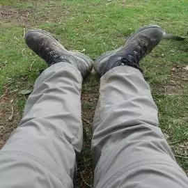 Wrodzony brak kości piszczelowej