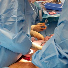 Błąd medyczny w czasie porodu