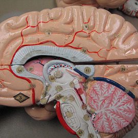 Heterotopie istoty szarej