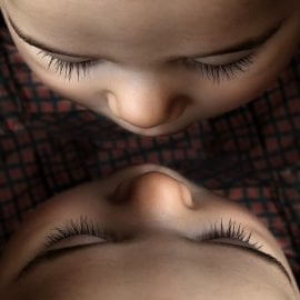 pasożytnicze bliźnięta