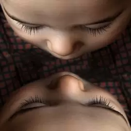 pasożytnicze bliźnięta