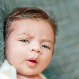 Diastroficzna dysplazja