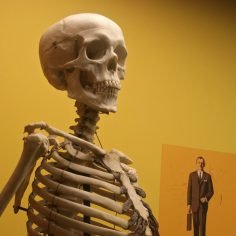 Wrodzona łamliwość kości