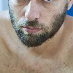 Łagodne nowotwory oka -