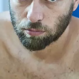 Łagodne nowotwory oka -