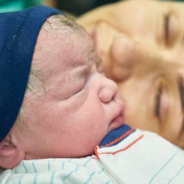 Żółtaczka fizjologiczna