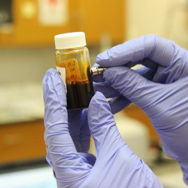 badanie stężenia DHEA