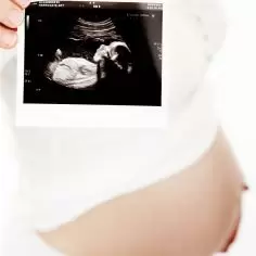 Konflikt serologiczny