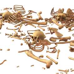 Dysplazja włóknista kości