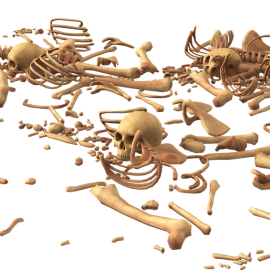 Dysplazja włóknista kości