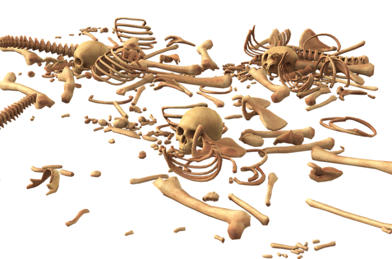 Dysplazja włóknista kości