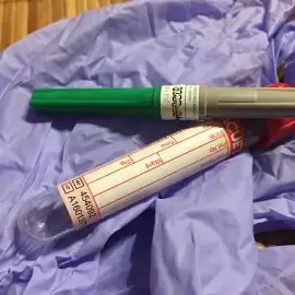 Talasemia