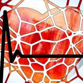 Zakrzepica zatok żylnych mózgu