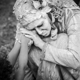 Przepuklina pachwinowa