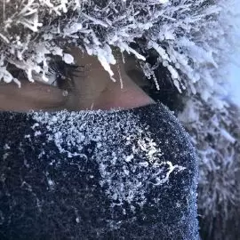 Ślepota śnieżna