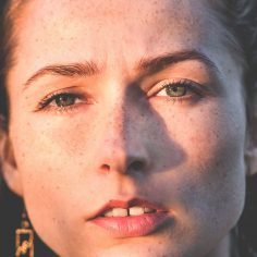 zwyrodnienia plamki żółtej oka