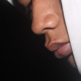 Leczenie niedosłuchu