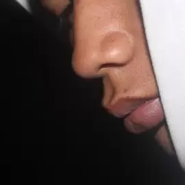 Leczenie niedosłuchu