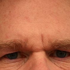 Dysmorfofobia