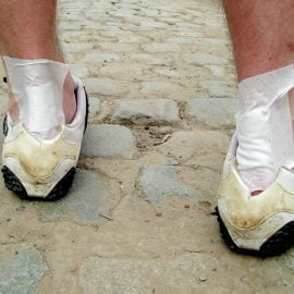 Naderwanie ścięgna